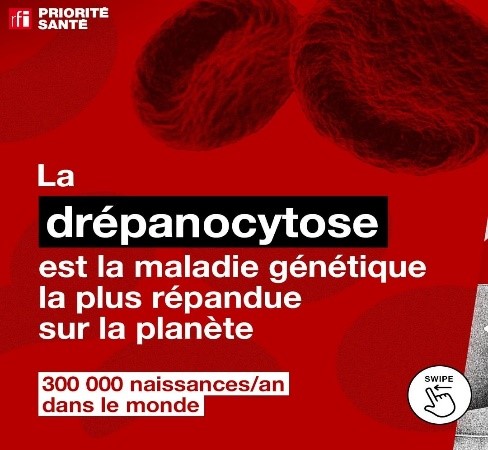 La drépanocytose – maladie génétique la plus répandue (RFI)