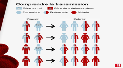 Comprendre la transmission de la drépanocytose (RFI)